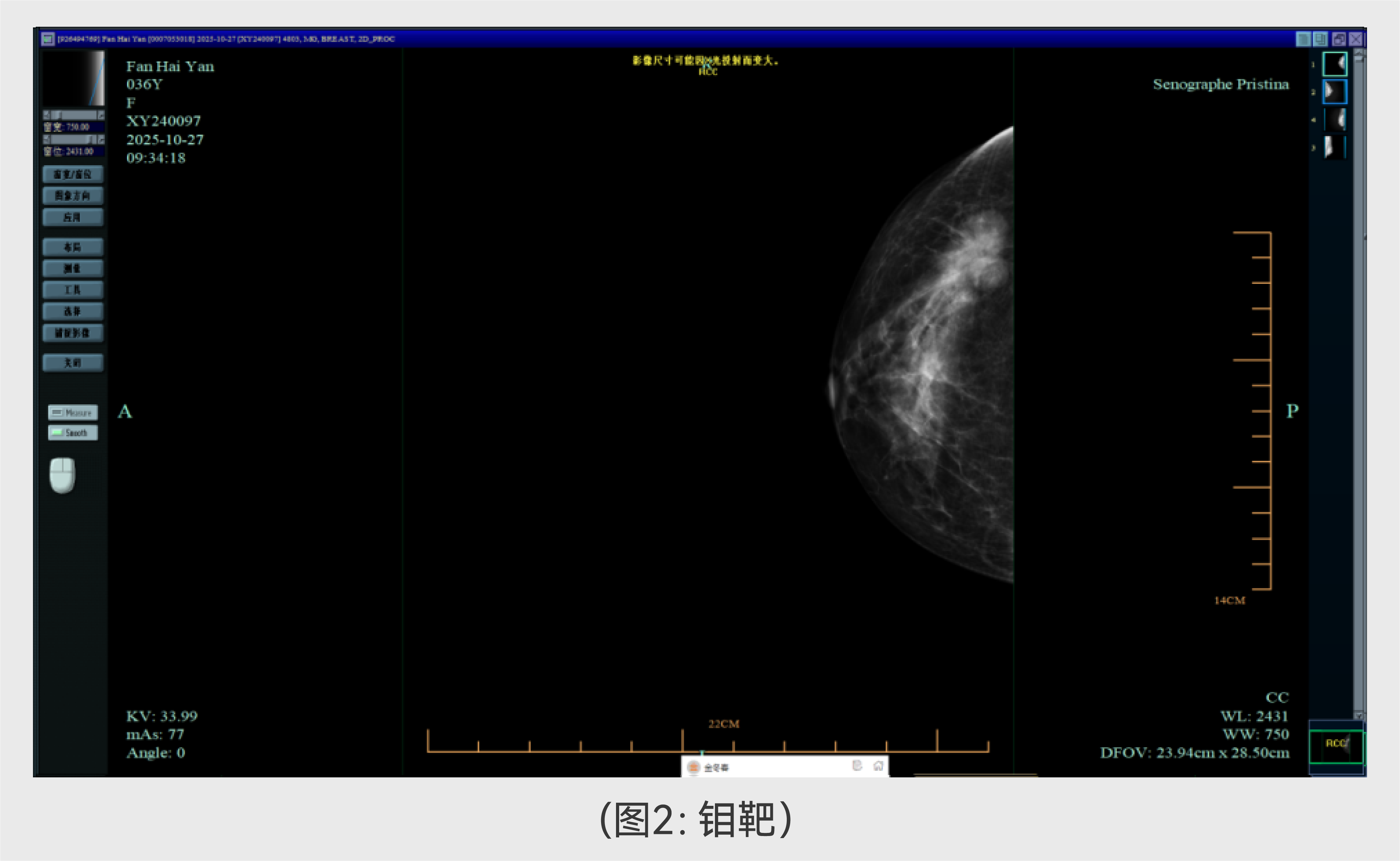 案例分享-04.png 案例分享-04.png