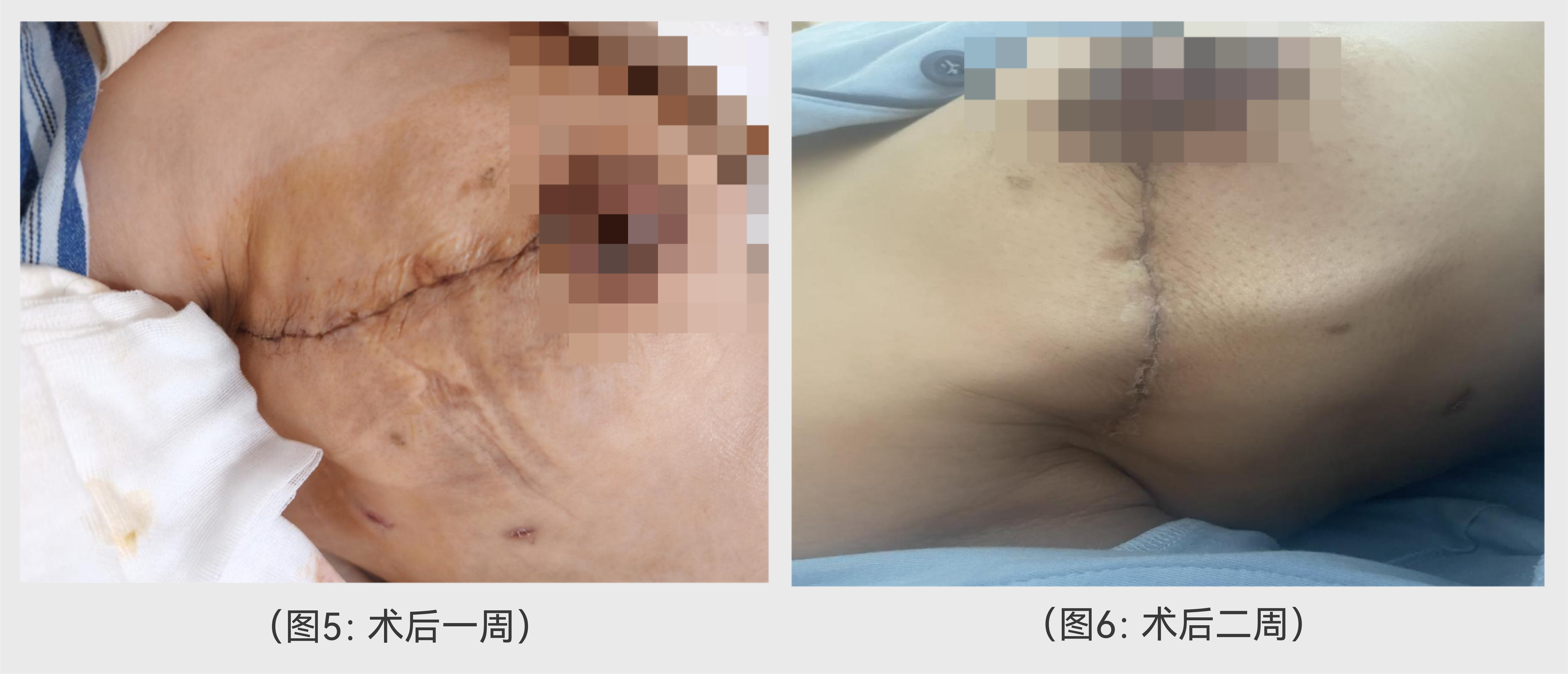 案例分享-08.png 案例分享-08.png