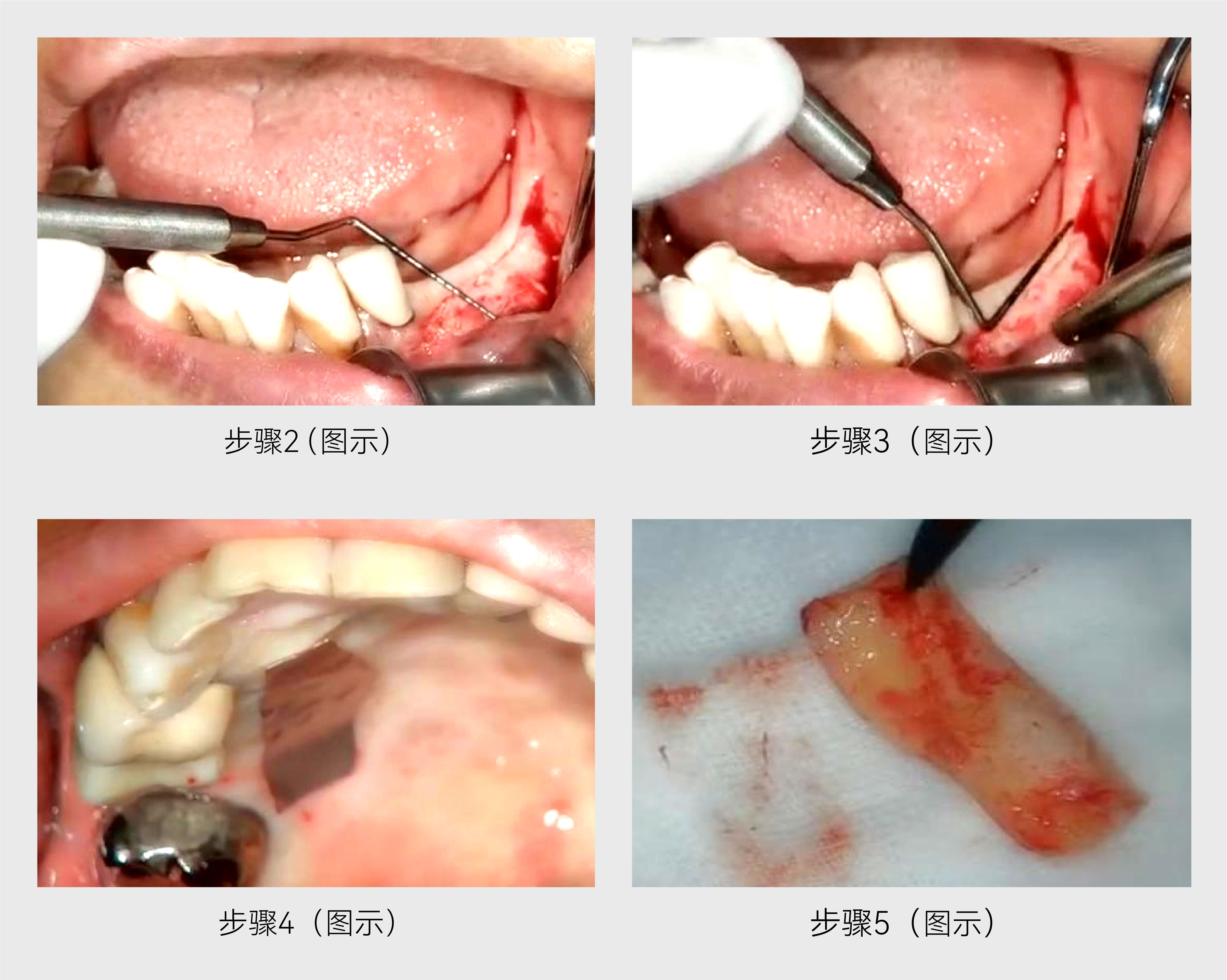 牙科分享-04.jpg 牙科分享-04.jpg
