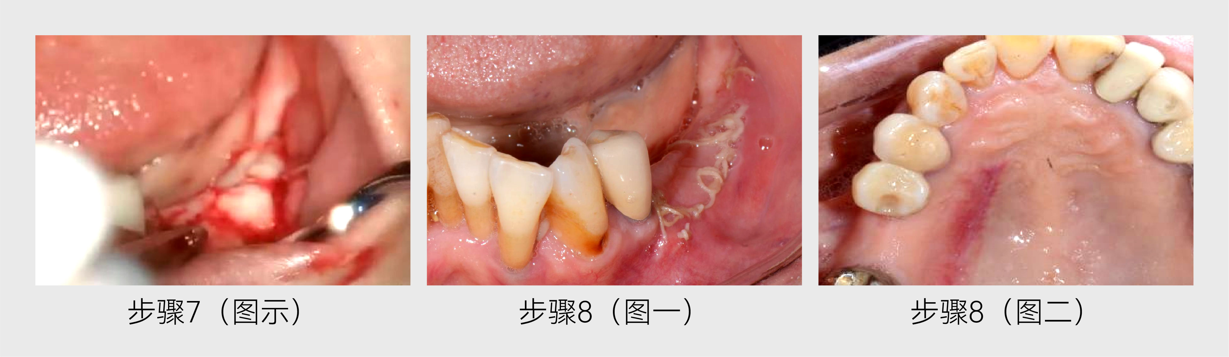 牙科分享-06.jpg 牙科分享-06.jpg