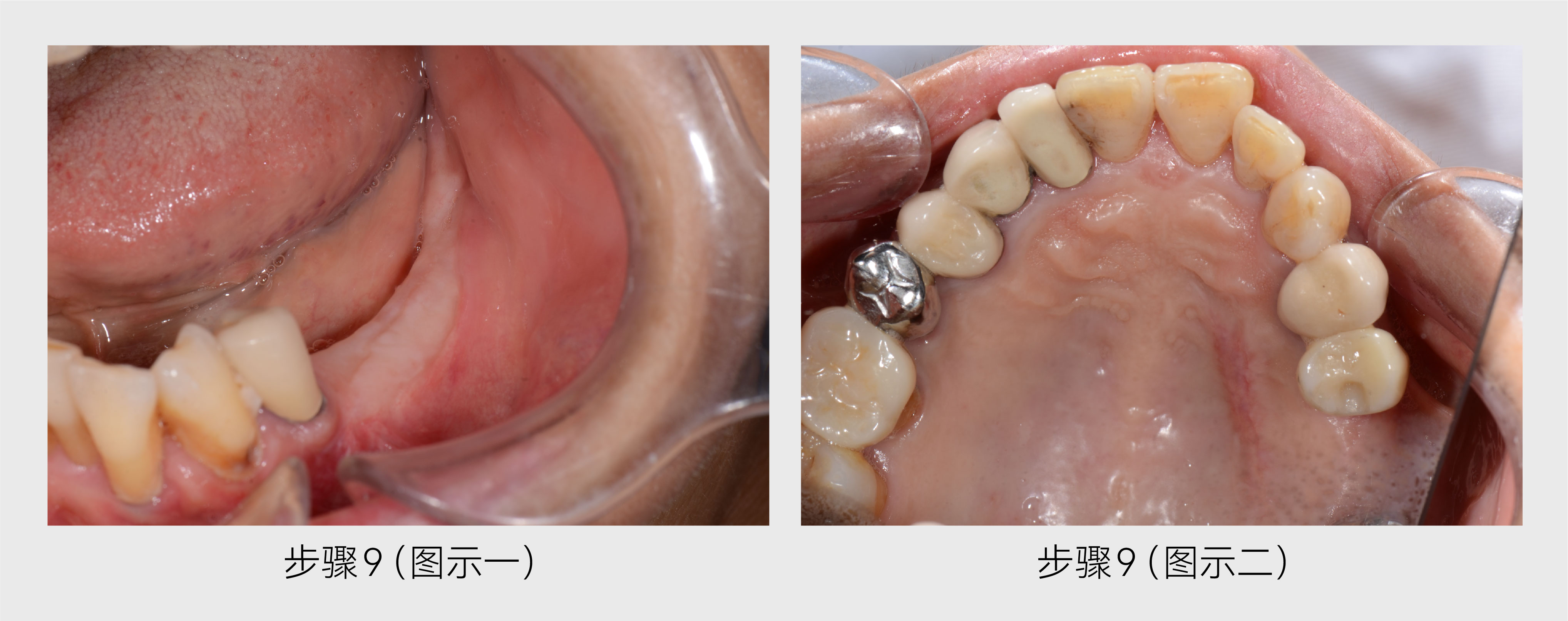 牙科分享-07.jpg 牙科分享-07.jpg