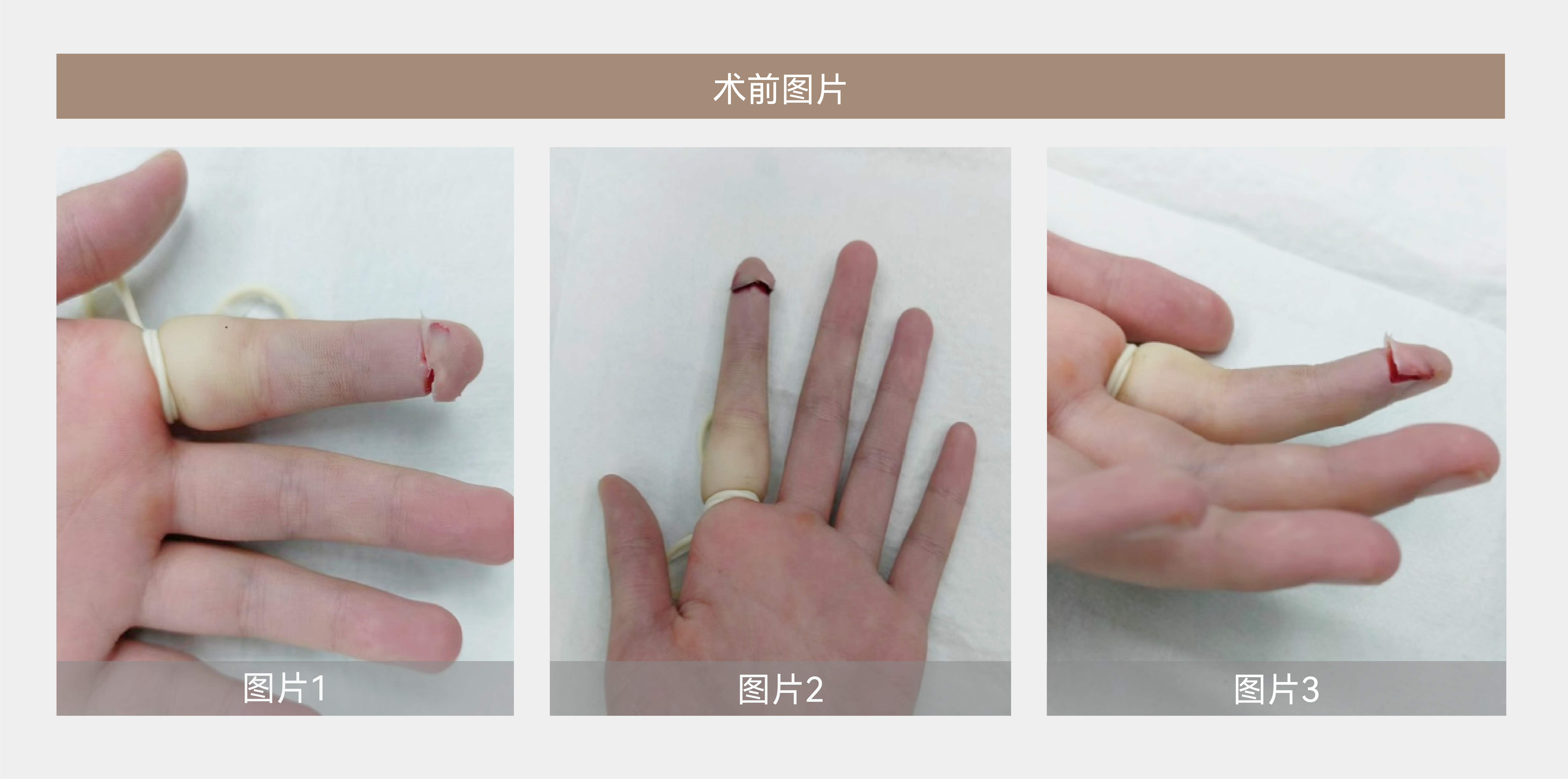 案例分享-02.png