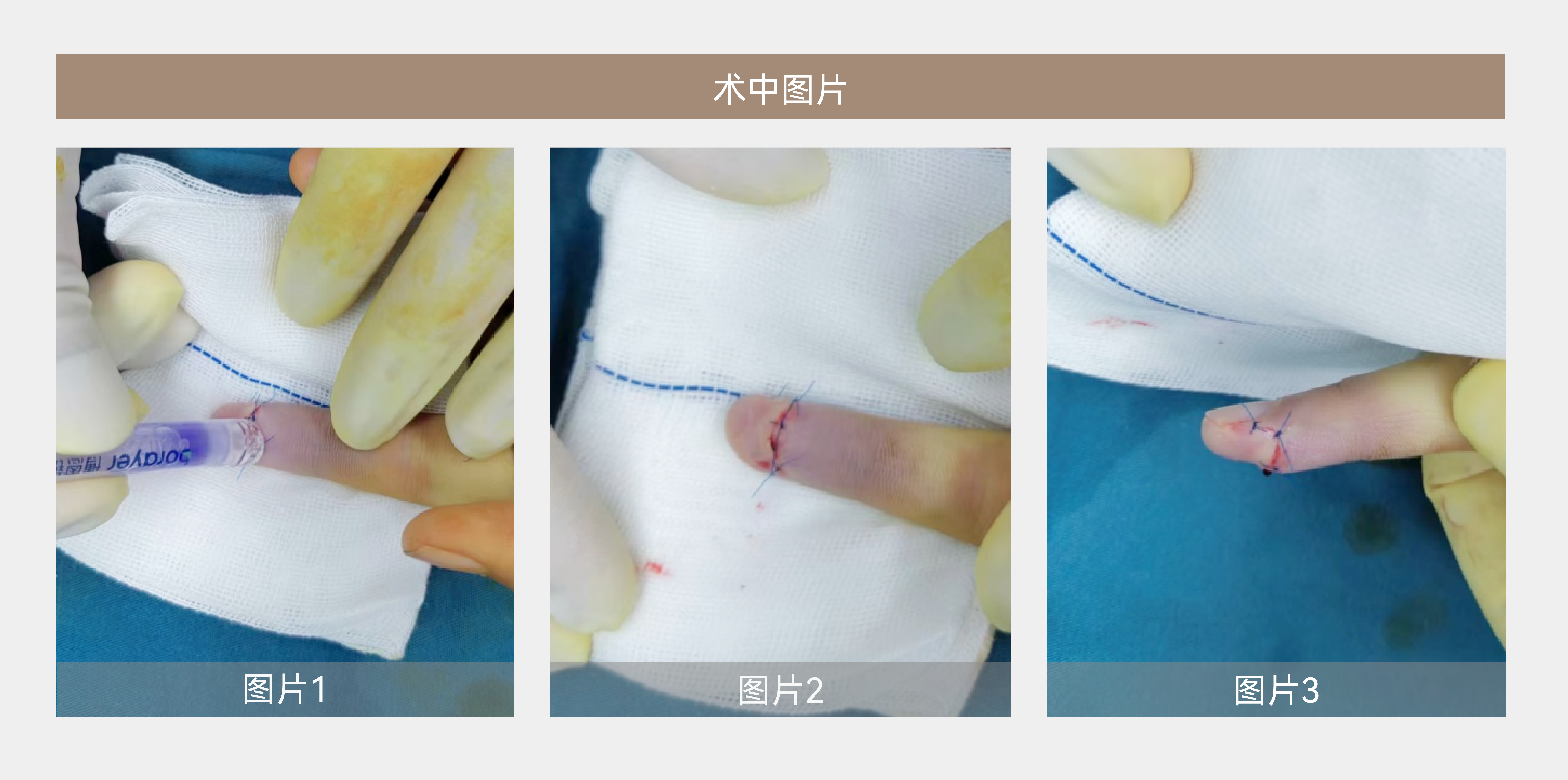 案例分享-03.png