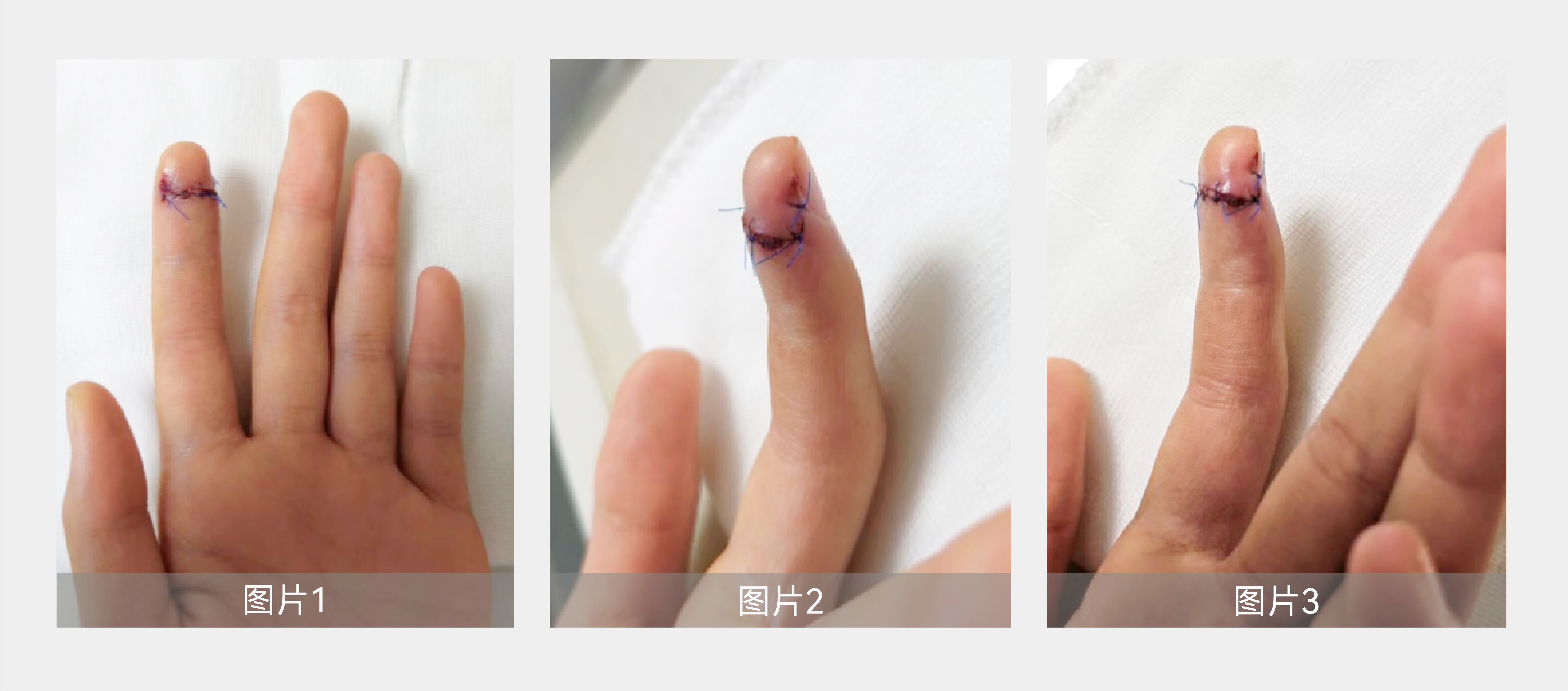 案例分享-04.png