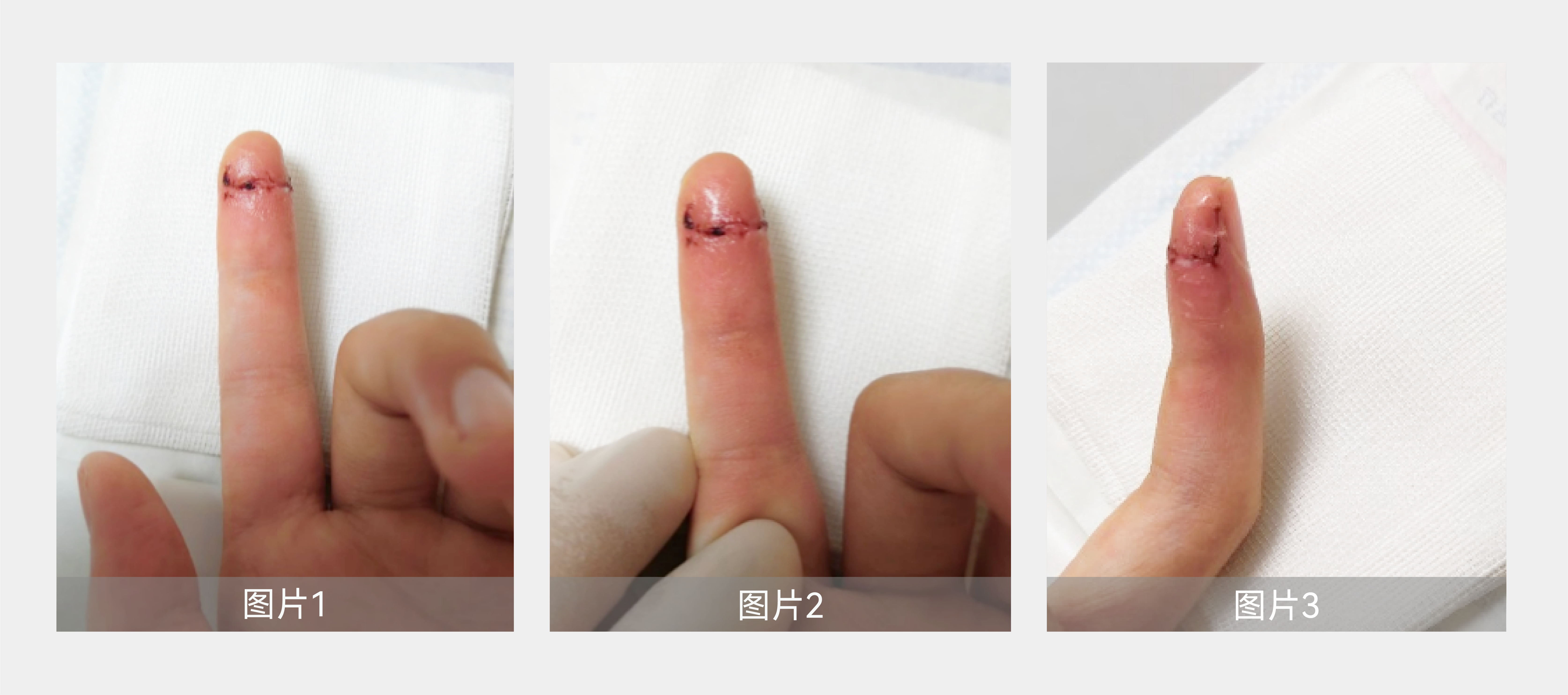 案例分享-05.png